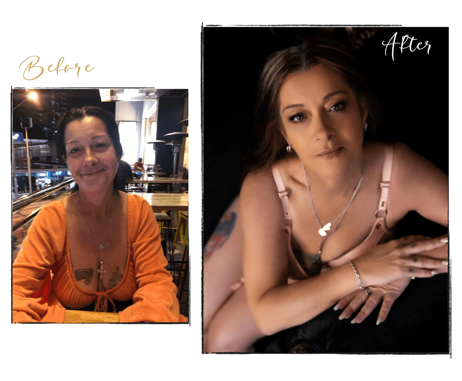 Cyndell before and after